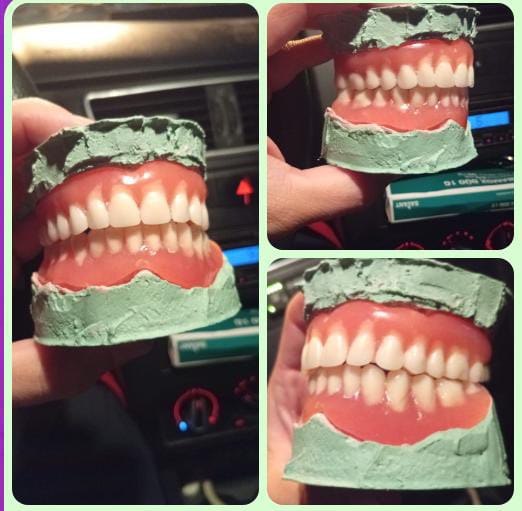 Prótesis dental confeccionada a medida